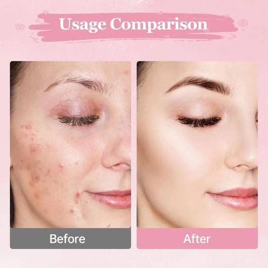 Tumeric Cleansing & Brightening Pads